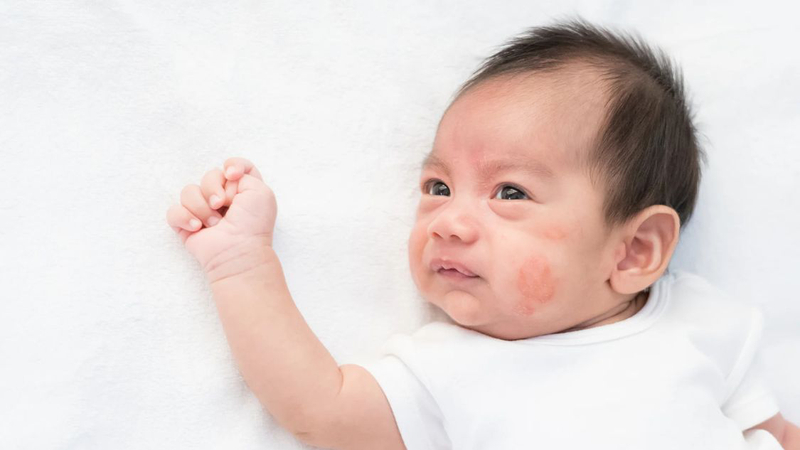 Trẻ sơ sinh hay đưa tay cào mặt là bình thường hay bất thường 3