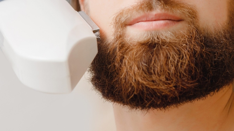 Nam giới có nên triệt râu không? Các phương pháp triệt râu vĩnh viễn 1