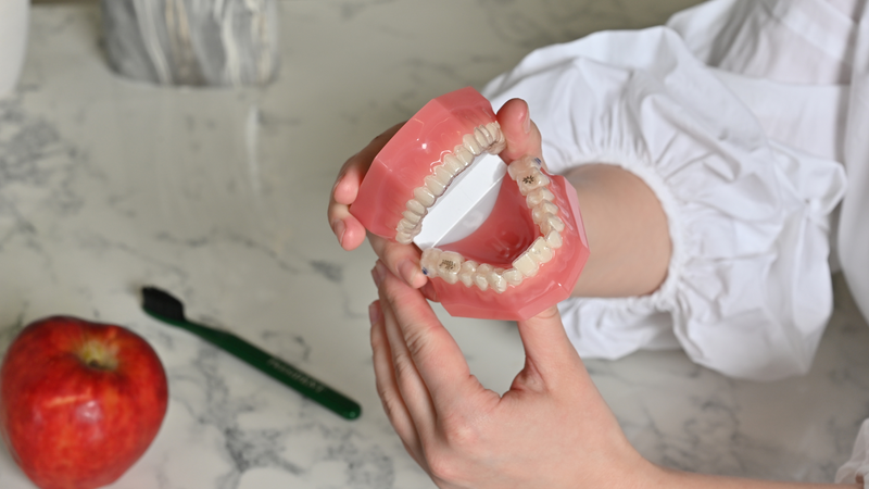Trồng răng tháo lắp có ưu và nhược điểm gì?​3