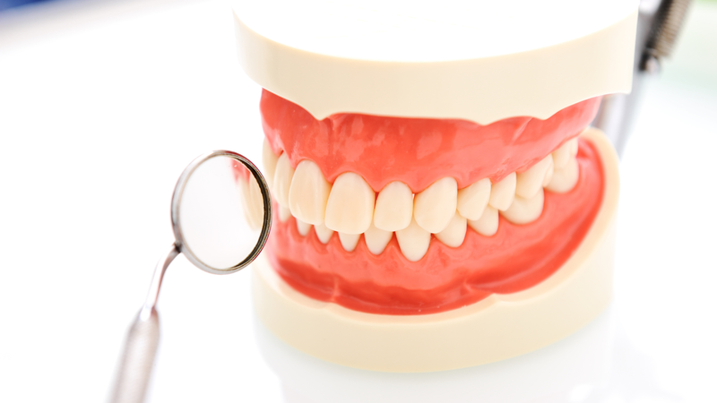 Trồng răng tháo lắp có ưu và nhược điểm gì?​4