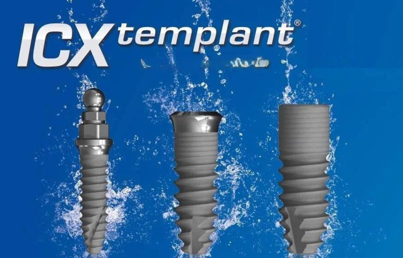 Trụ Implant ICX có tốt không? So sánh trụ Implant ICX với các loại khác 1