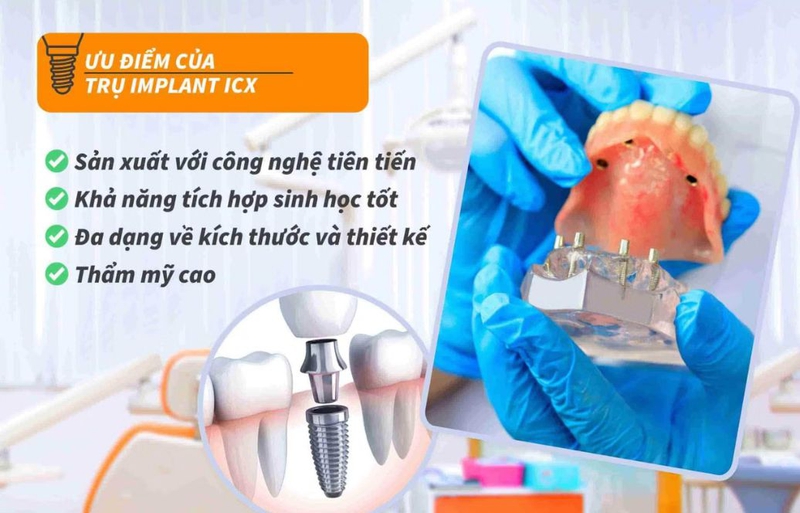 Trụ Implant ICX có tốt không? So sánh trụ Implant ICX với các loại khác 3