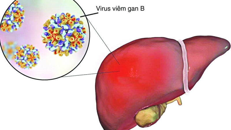 Trước khi quan hệ nên tiêm phòng gì để bảo vệ sức khỏe toàn diện? 3