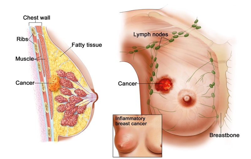 Tumor markers là gì? 6 ứng dụng của tumor markers đem lại trong lâm sàng 6