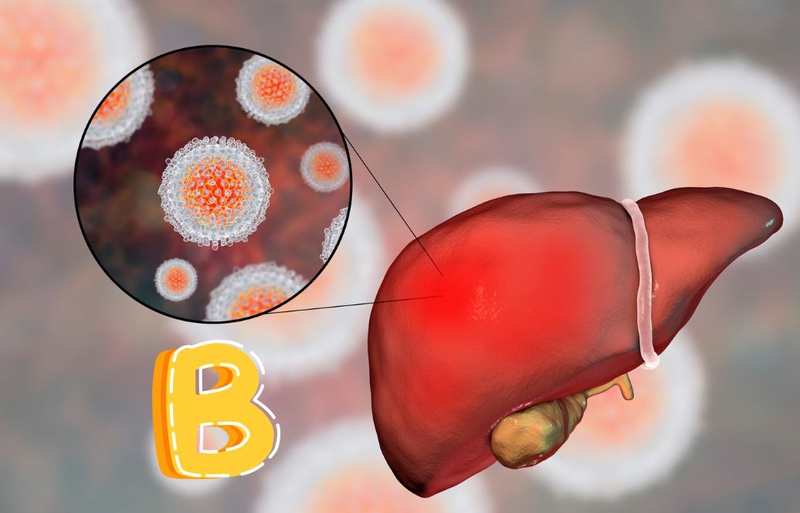 Tỷ lệ viêm gan B ở Việt Nam và biện pháp kiểm soát bệnh 2