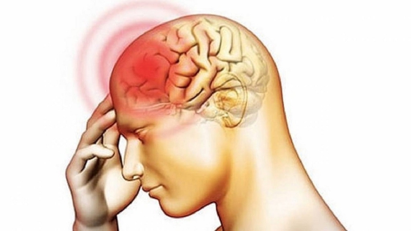 U não nguyên phát và thứ phát là gì? Nguyên nhân gây ra u não nguyên phát và thứ phát 1