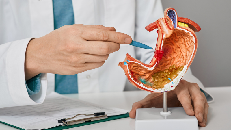 Ung thư dạ dày có lây không? Vì sao nhiều người lầm tưởng ung thư dạ dày có thể lây? 3