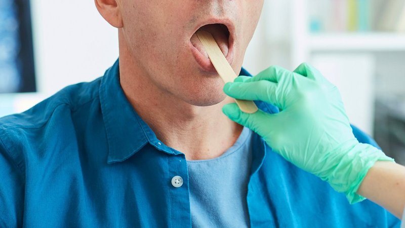 Ung thư khoang miệng là gì? Nguyên nhân và cách điều trị ung thư khoang miệng 5