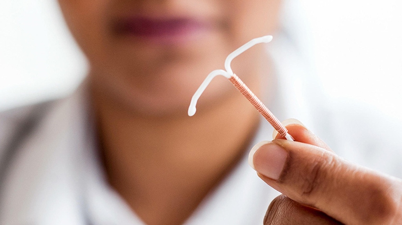 Ưu nhược điểm của đặt vòng tránh thai: Lựa chọn thông minh cho phụ nữ 2