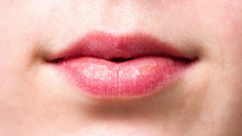 Ưu và nhược điểm của phun môi không ủ tê? Những chú ý sau khi phun môi 4