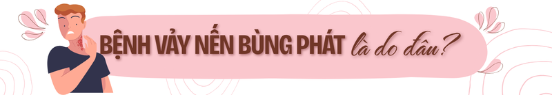 Vảy nến không chỉ là bệnh ngoài da: Đừng bỏ qua những tổn thương bên trong cơ thể! 4