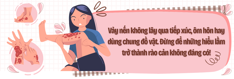 Vảy nến không chỉ là bệnh ngoài da: Đừng bỏ qua những tổn thương bên trong cơ thể! 3