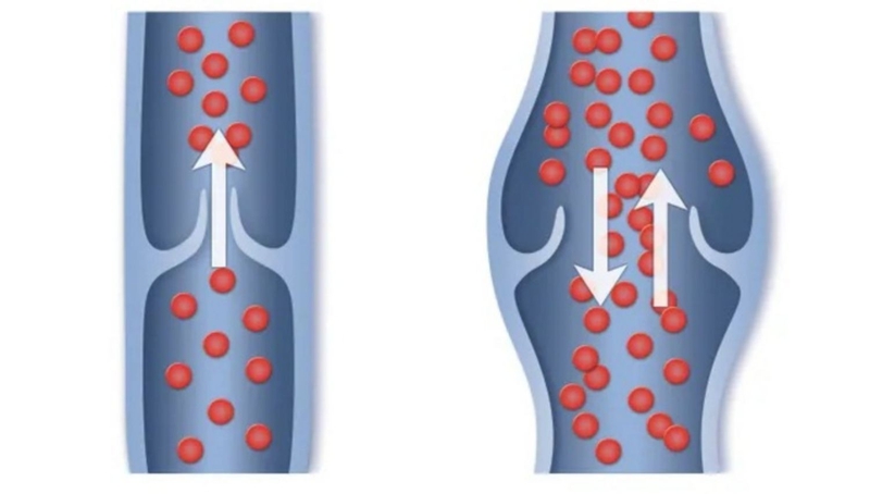 Vein là gì và chức năng của vein như thế nào? -2