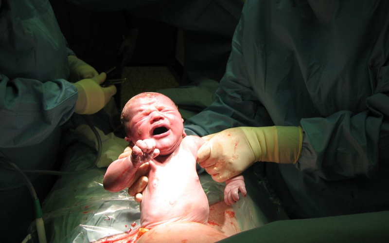 Vết mổ đẻ lần 2 bao lâu thì lành​? Cách giúp vết mổ đẻ nhanh lành 1
