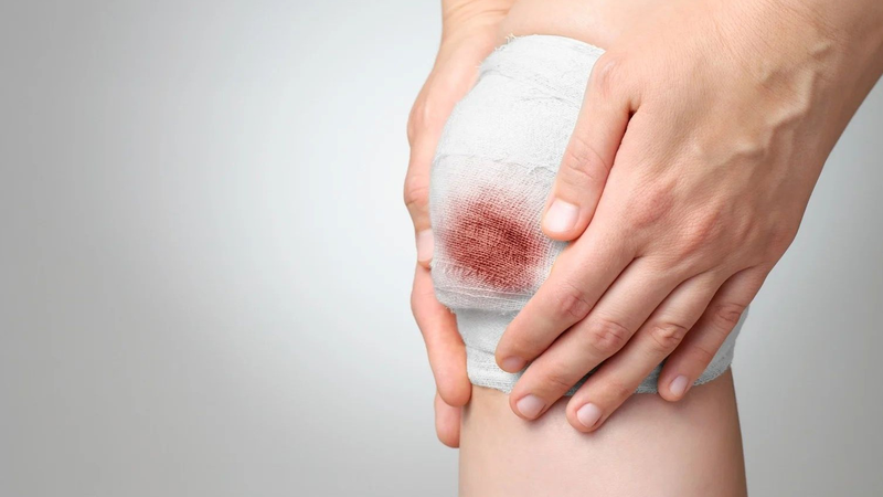 Vết thương hở có tự lành được không phụ thuộc vào kích thước, độ sâu và độ nghiêm trọng của vết thương