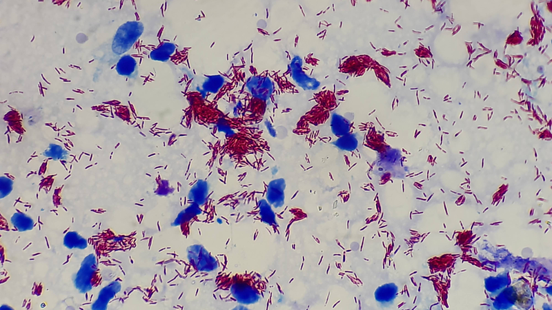 Vi khuẩn Mycobacterium leprae dạng trực khuẩn mảnh, xếp thành từng nhóm hình bó que