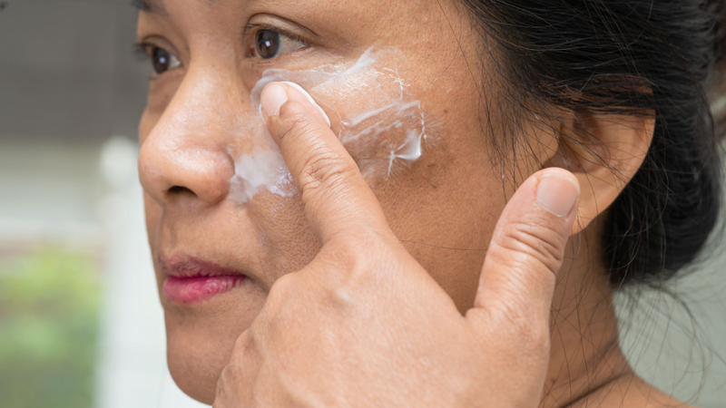 Kích ứng da khi dùng kem trị nám là một trong những nguyên nhân thường gặp của trị nám các vết nám lại đậm hơn