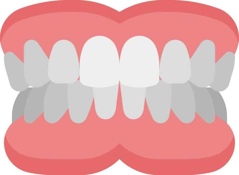 Vì sao răng chuyển màu xanh? Cách để phòng ngừa tình trạng răng chuyển màu1