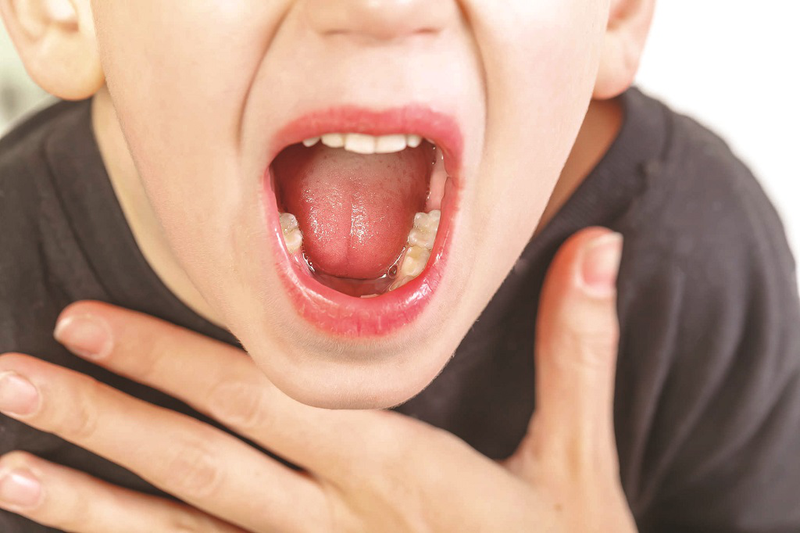 Viêm amidan đáy lưỡi do nguyên nhân gì? Nhận biết triệu chứng và cách điều trị liên quan? 1