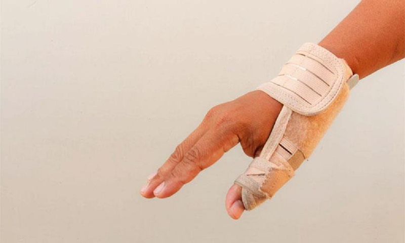 Viêm bao gân mỏm trâm quay cổ tay: Nguyên nhân, chẩn đoán và điều trị 3