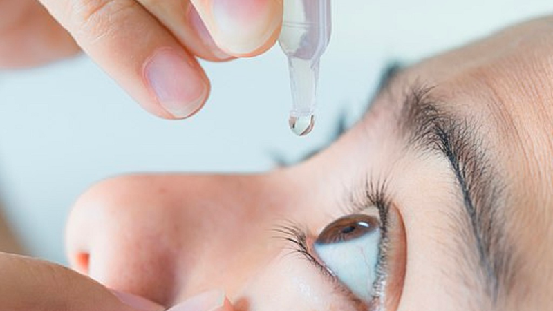 Viêm bờ trên mi mắt là gì? Nguyên nhân, triệu chứng và cách điều trị 7