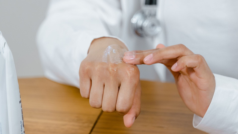 Viêm da tiết bã và vảy nến: Phân Biệt chính xác và cách chăm sóc da hiệu quả ngay tại nhà 3