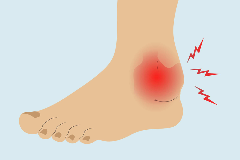 Viêm khớp cổ chân là gì? Những vấn đề cần biết về bệnh lý viêm khớp cổ chân 4