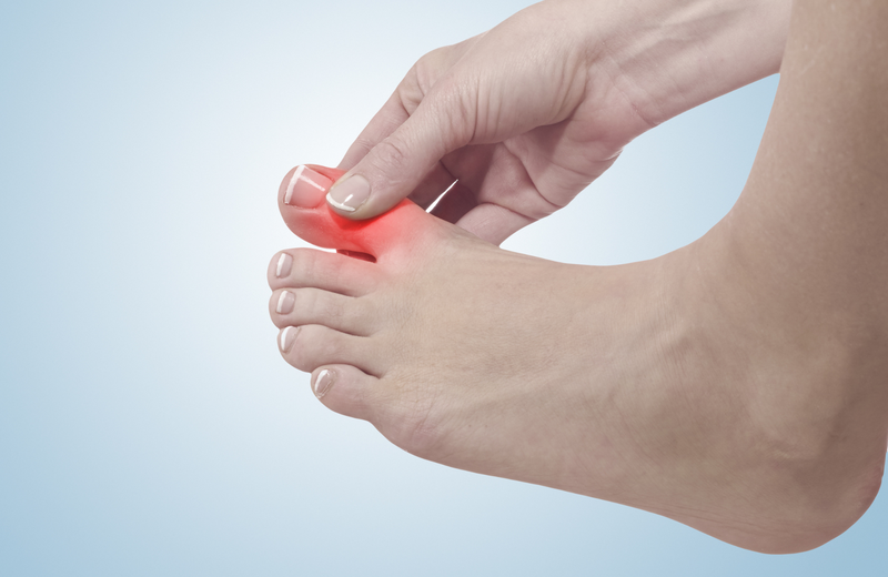 Viêm khớp ngón chân là gì? Những vấn đề cần biết về bệnh lý viêm khớp ngón chân 4