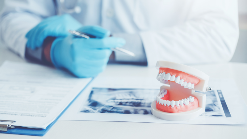 Viêm lợi có mủ: Nguyên nhân, triệu chứng và cách điều trị hiệu quả 4