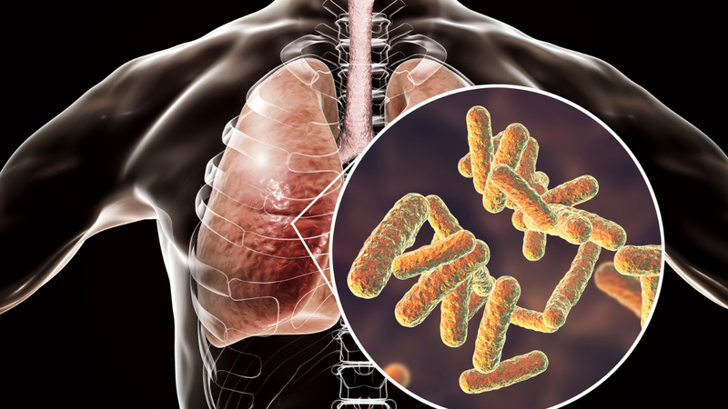 Viêm phổi do Klebsiella Pneumoniae nguy hiểm như thế nào? 3
