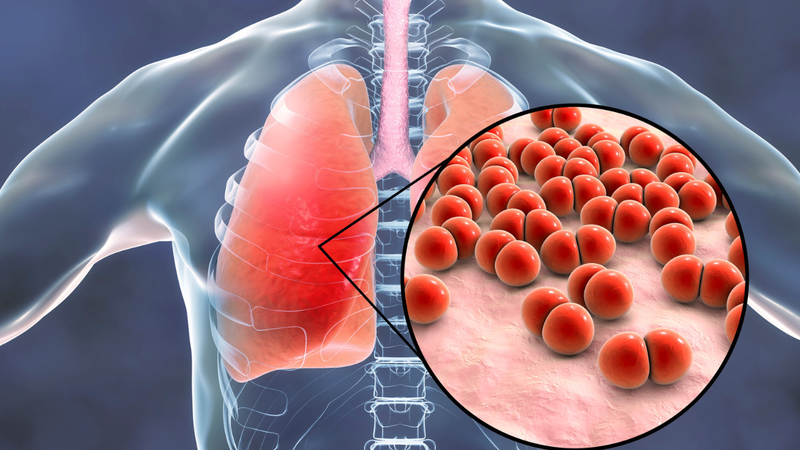 Viêm phổi do Klebsiella Pneumoniae nguy hiểm như thế nào? 1