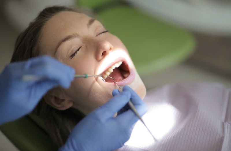 Viêm quanh thân răng cấp: Nguyên nhân, triệu chứng và cách điều trị 3