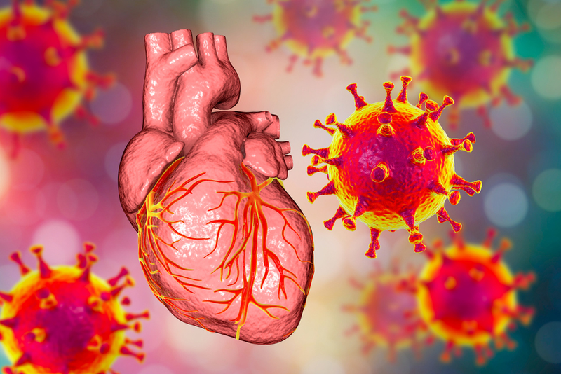 Virus gây viêm cơ tim là gì? Tình trạng viêm cơ tim ở trẻ em liệu có nguy hiểm không? 3