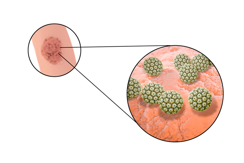 Virus HPV ở nam giới: Tầm soát và phòng ngừa 1