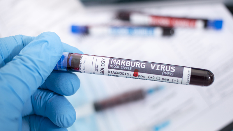 Virus Marburg nguy hiểm như thế nào? 2