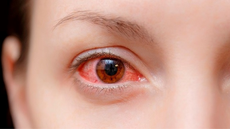 Vitamin A bổ mắt như thế nào? 2