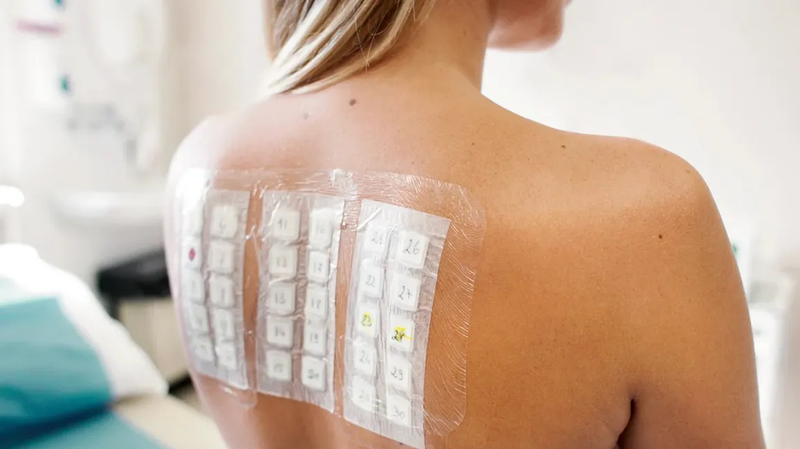 Xét nghiệm 91 dị nguyên: Cách phát hiện và điều trị dị ứng hiệu quả 2