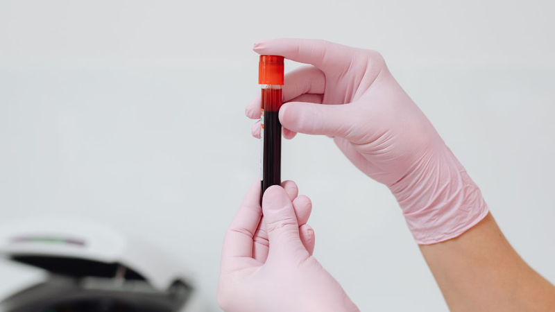 Xét nghiệm Antithrombin III được chỉ định trong nhiều trường hợp