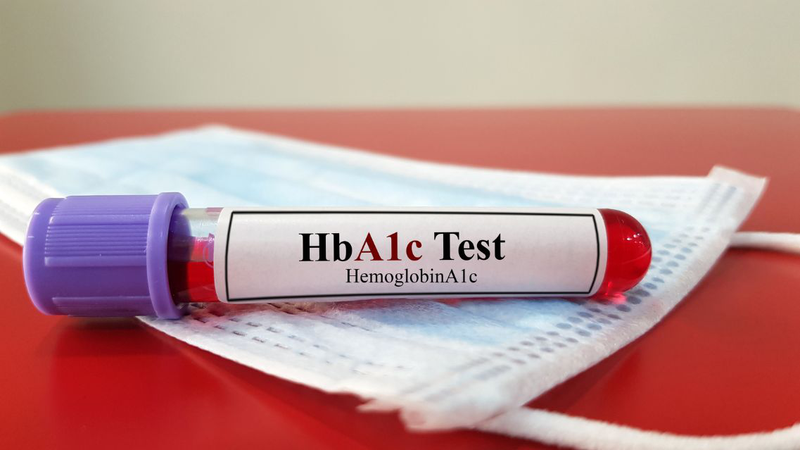 Xét nghiệm HbA1c giá bao nhiêu là thông tin nhiều người muốn biết