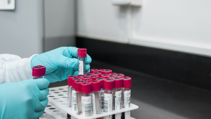 Mức giá xét nghiệm HbA1c ở các cơ sở y tế công lập khá hợp lý