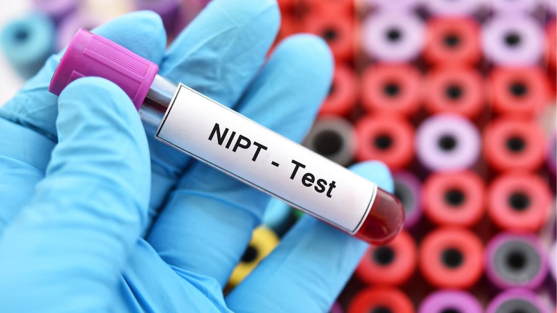 Xét nghiệm NIPT có phát hiện hở hàm ếch không 2