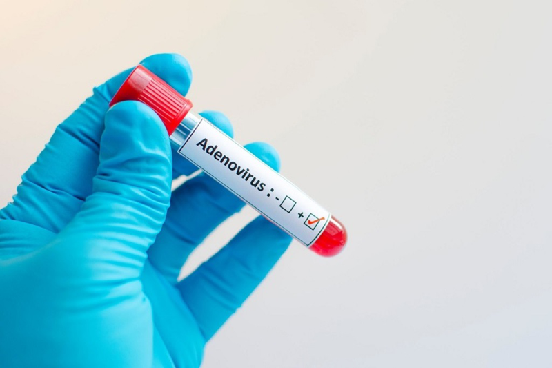 Xét nghiệm adenovirus là gì? Các cách xét nghiệm adenovirus? 3