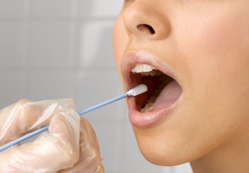 Xét nghiệm ADN bằng niêm mạc miệng có đúng không? Thực hiện như thế nào? 2