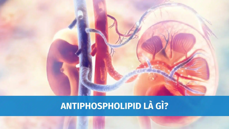 Xét nghiệm anti phospholipid igm là gì? -1