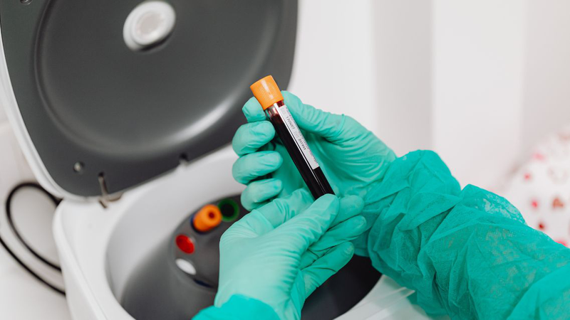 Có thể xét nghiệm công thức máu 18 thông số chủ động hoặc theo chỉ định