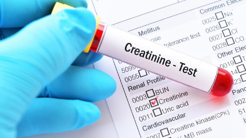 Xét nghiệm creatinin và ý nghĩa của creatinin trong chẩn đoán suy thận