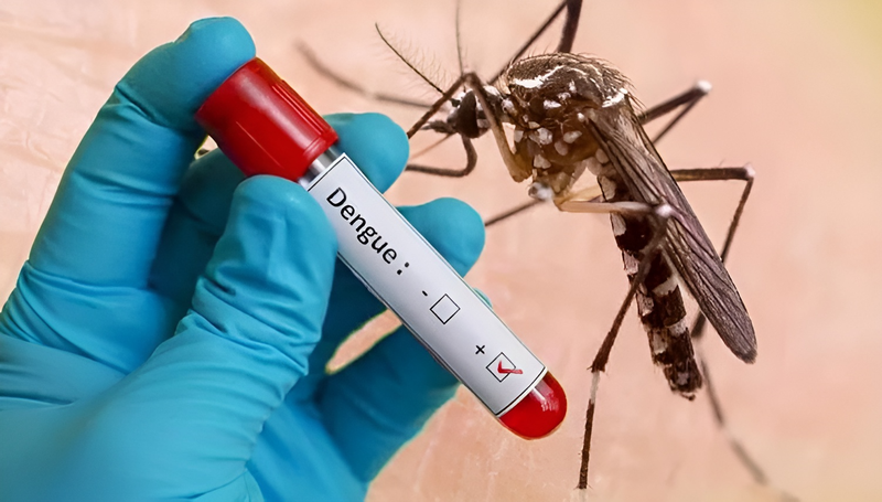 Xét nghiệm Dengue IgG là gì? Kết quả xét nghiệm Dengue IgG dương tính phản ánh điều gì? 1