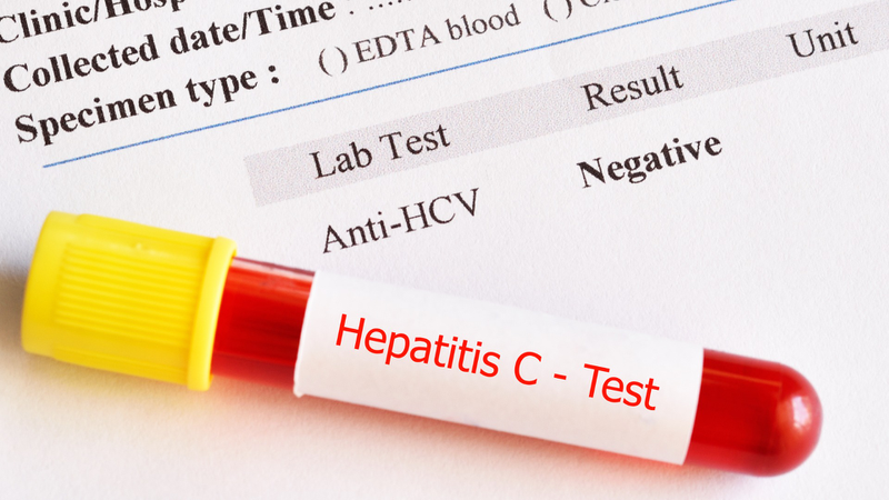Xét nghiệm định lượng virus viêm gan C là gì? Cần làm gì nếu dương tính? 1