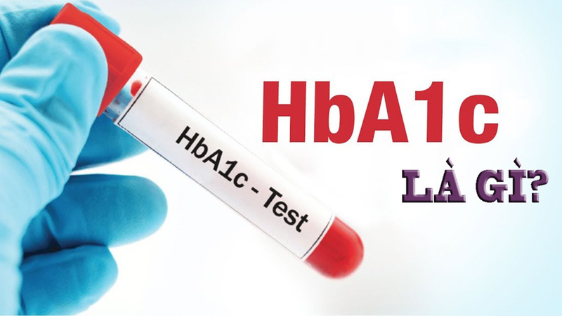 Xét Nghiệm HbA1c: Những điều cần biết để giám sát bệnh đái tháo đường hiệu quả 1