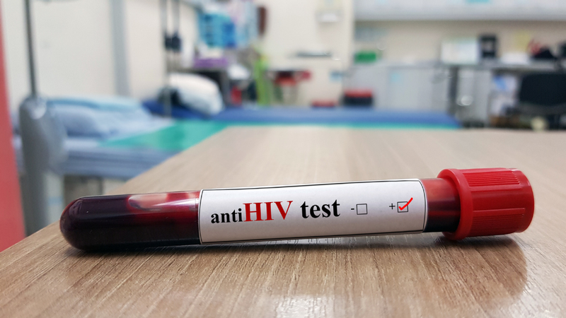 Xét nghiệm HIV 5 tháng âm tính đã an toàn chưa?  Điều cần biết về HIV và xét nghiệm HIV 2